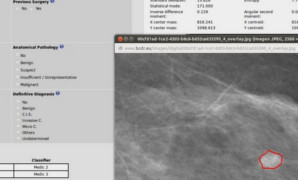 Más datos en el Repositorio Digital de Cáncer de Mama